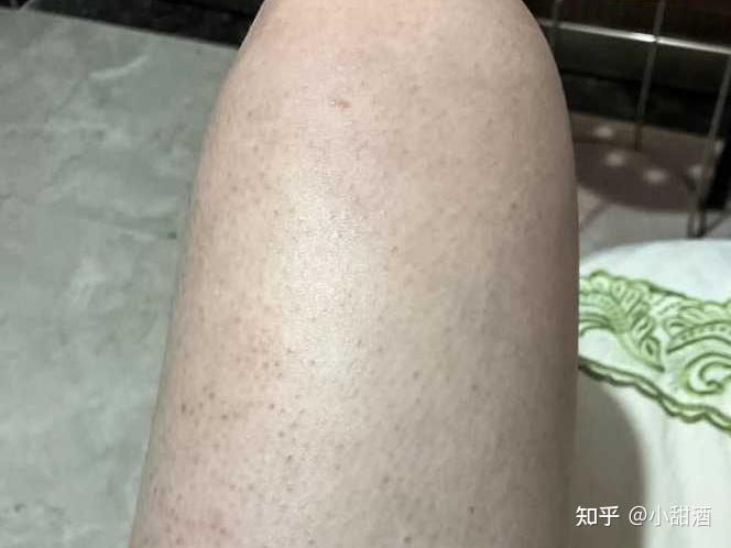 如何使鸡皮肤更鲜嫩(如何使鸡皮肤更鲜嫩一点) 如何使鸡皮肤更鲜嫩(如何使鸡皮肤更鲜嫩一点)