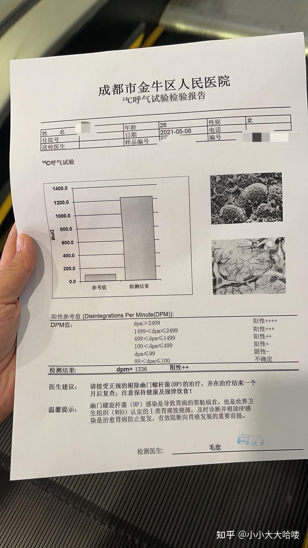 幽门螺旋杆菌治疗路程