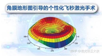 避坑防雷近視手術5分鐘檢查兩小時術前檢查原來這麼重