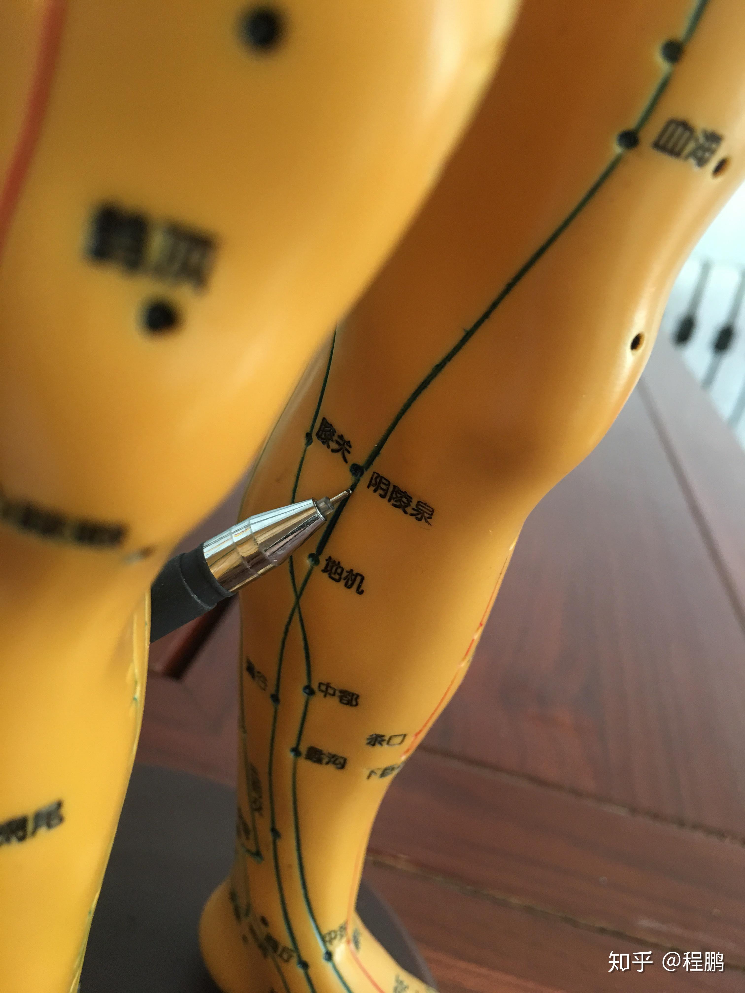 拔罐调理病症之膝关节痛