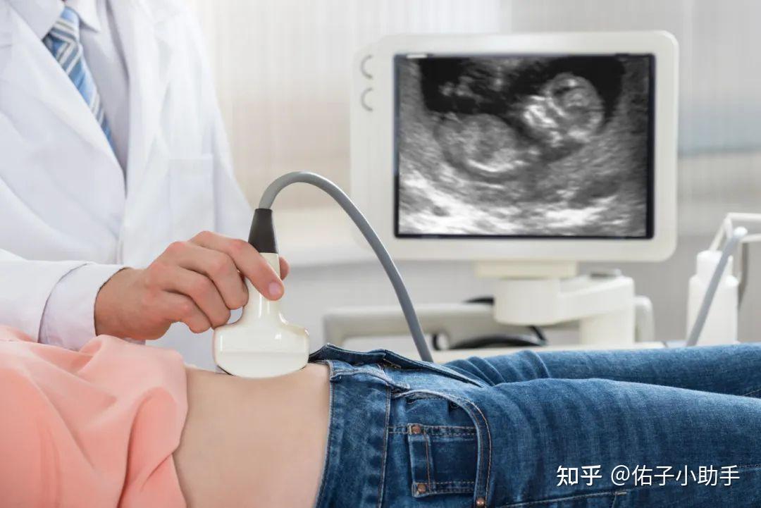 女性双子宫之谜：从形成到影响，一次说清！ - 知乎