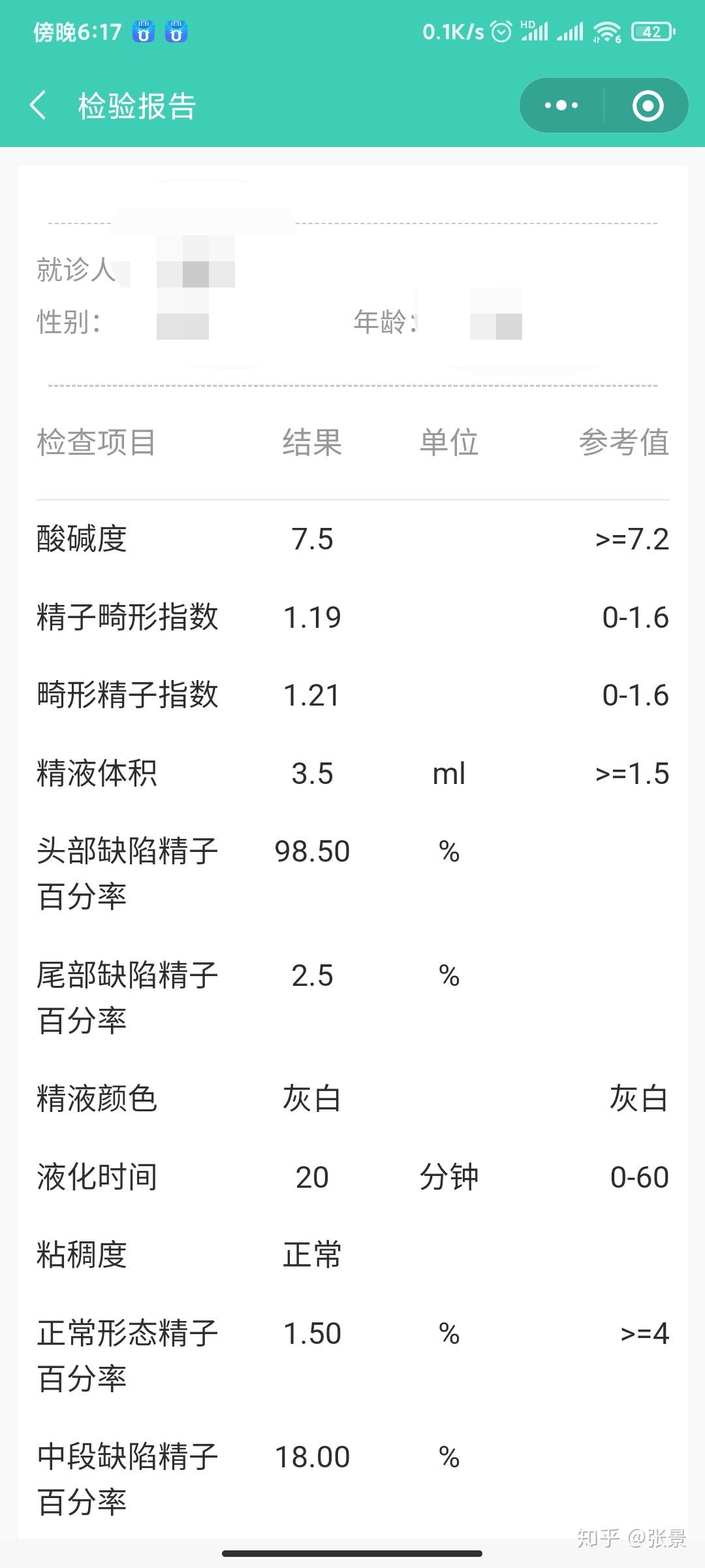 考虑后还是决定尽快手术治疗,左侧精索静脉曲张ii度,精子畸形率98.5%.