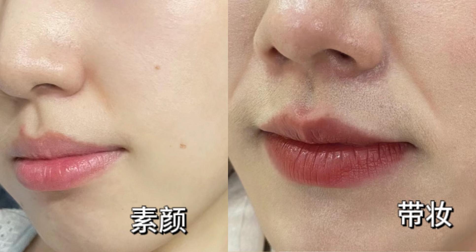 【女生法令纹必看】如果你的法令纹很显老,让化妆师教你几招去除法令纹的方法,年轻10+岁很简单! - 知乎