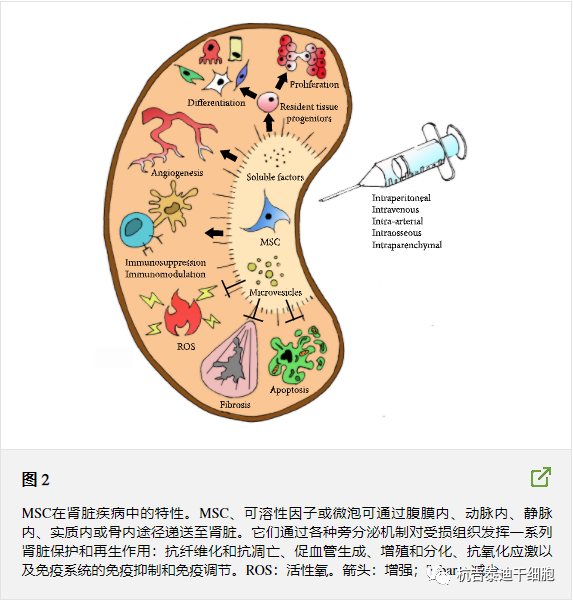 间充质干细胞治疗六大类肾脏疾病:临床证据回顾