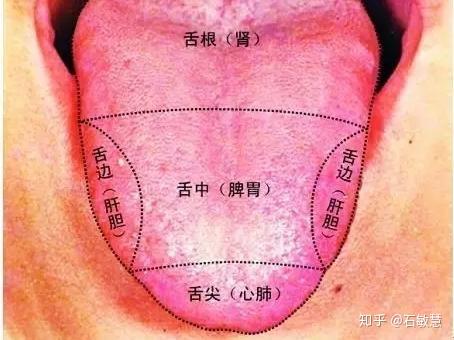如何从舌头上看病 常看这些部位能判断多种病 知乎