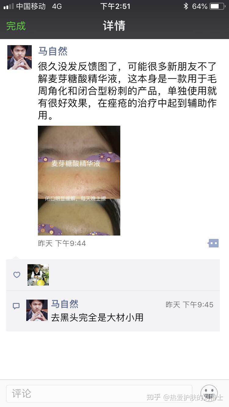 v2-4d69a301955eaf4cd99c62c22e1f9acf_r.jpg