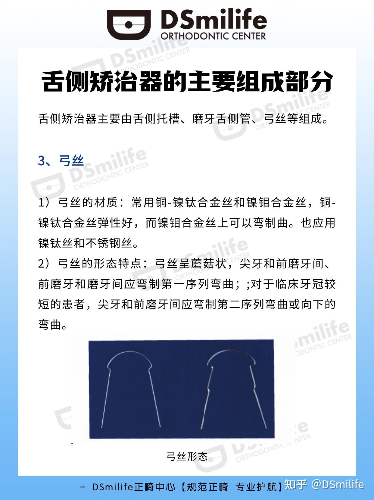 DS正畸|舌侧矫治器的主要组成部分 - 知乎