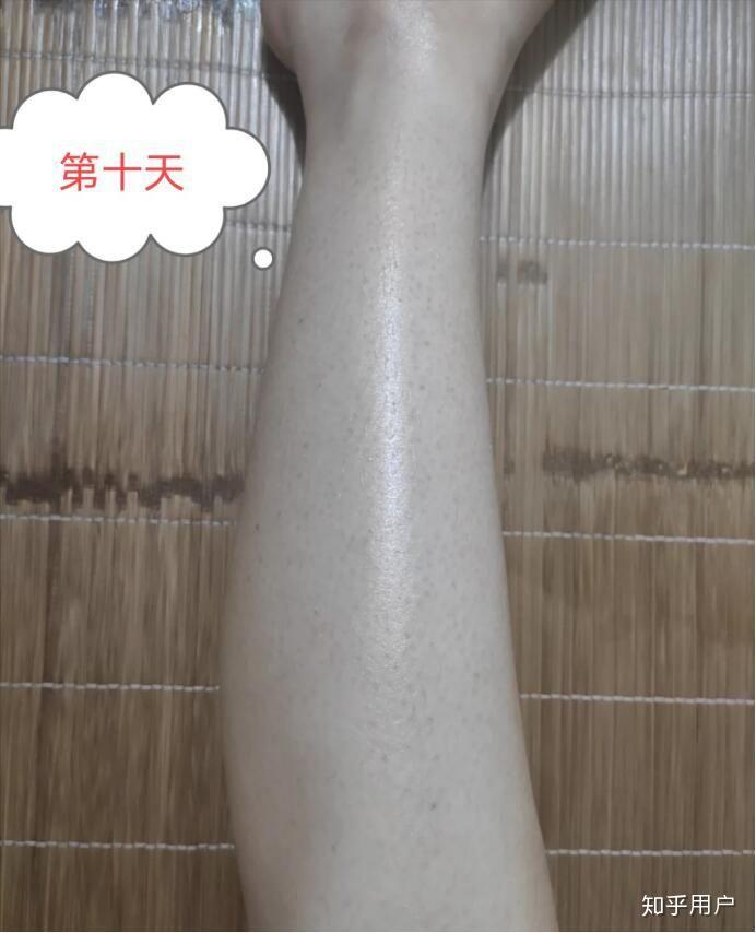 鸡皮肤买什么护肤品知乎(网上去鸡皮肤的护肤品真的有效吗)