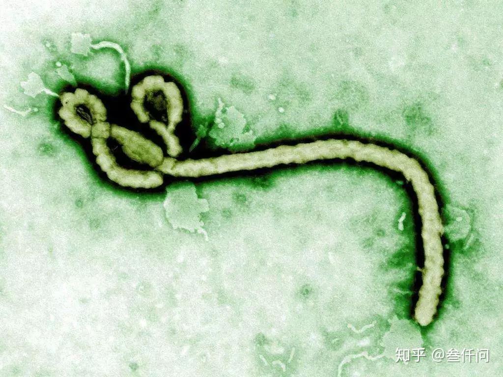 埃博拉病毒归档 - 92电影解说网
