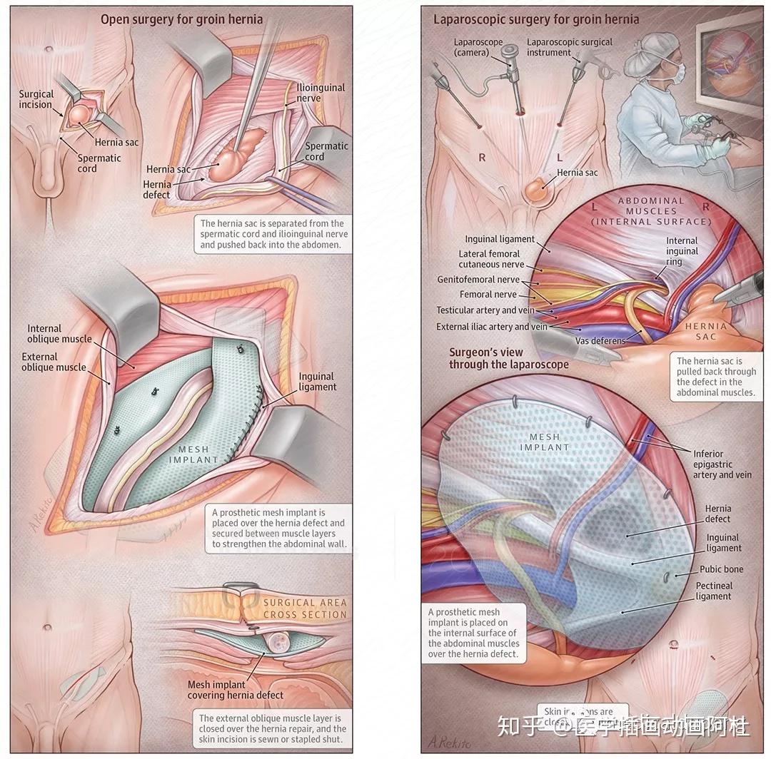2018年美国医学插画协会ami沙龙展巡礼六十二