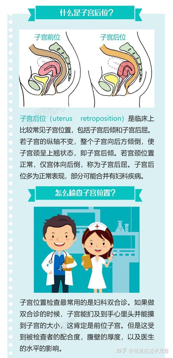 图明白丨子宫后位会影响我怀孕吗? - 知乎