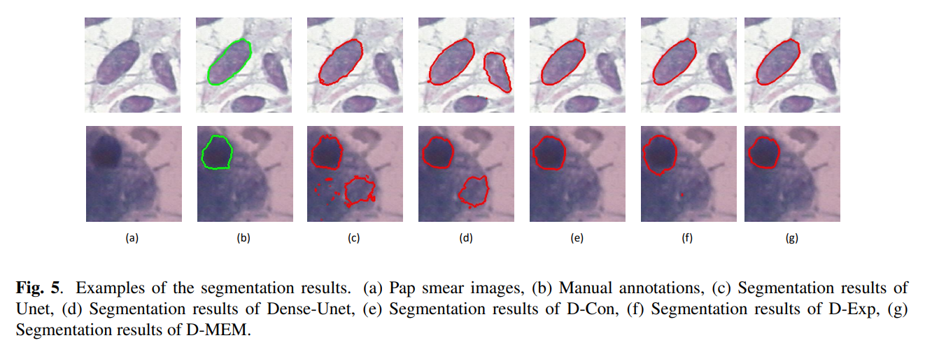 segmentation of cervical nuclei in pap smear images using