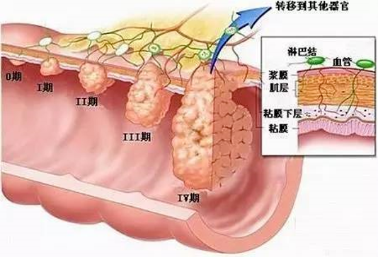 直肠分层5层示意图图片