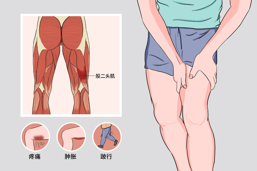 膝关节骨性关节炎卡通图片