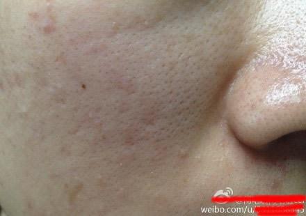 换季你的脸闹脾气了吗丨时尚研究院