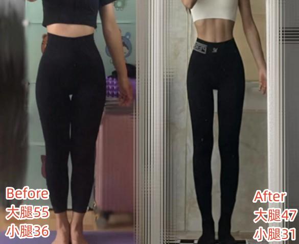 腿粗分3种类型：肌肉腿、脂肪腿、水肿腿，你属于哪一种？