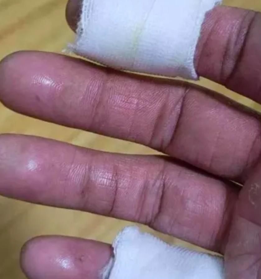 退伍军人爬梯灭火突遭意外血哗哗地流之后的选择感动一座城