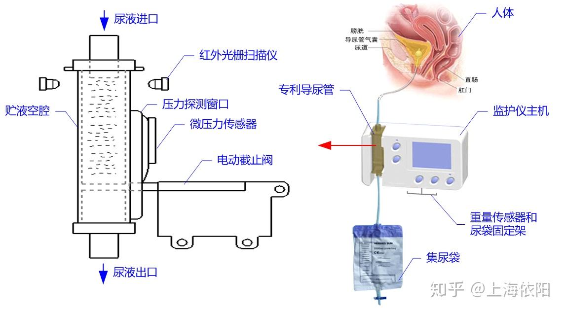 泌尿系统动态监护仪器:国内外发展现状和关键技术分析