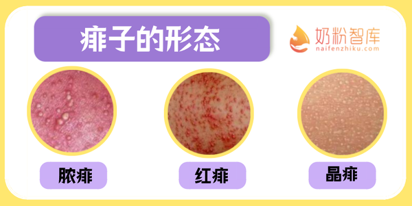 宝宝出疹子了，是湿疹、痱子还是其他皮疹？教你辨别和处理！ - 知乎