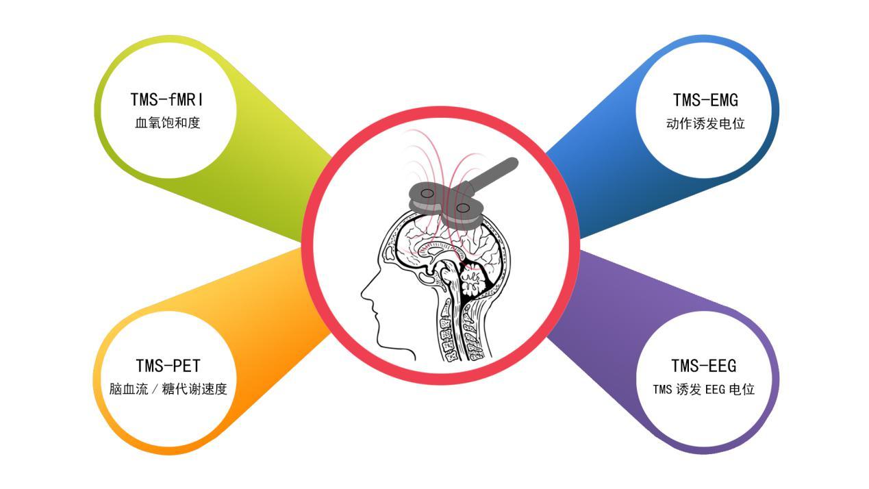 最好的效果;這一領域通常把結構和功能性mri(fmri)的數據與tms相結合