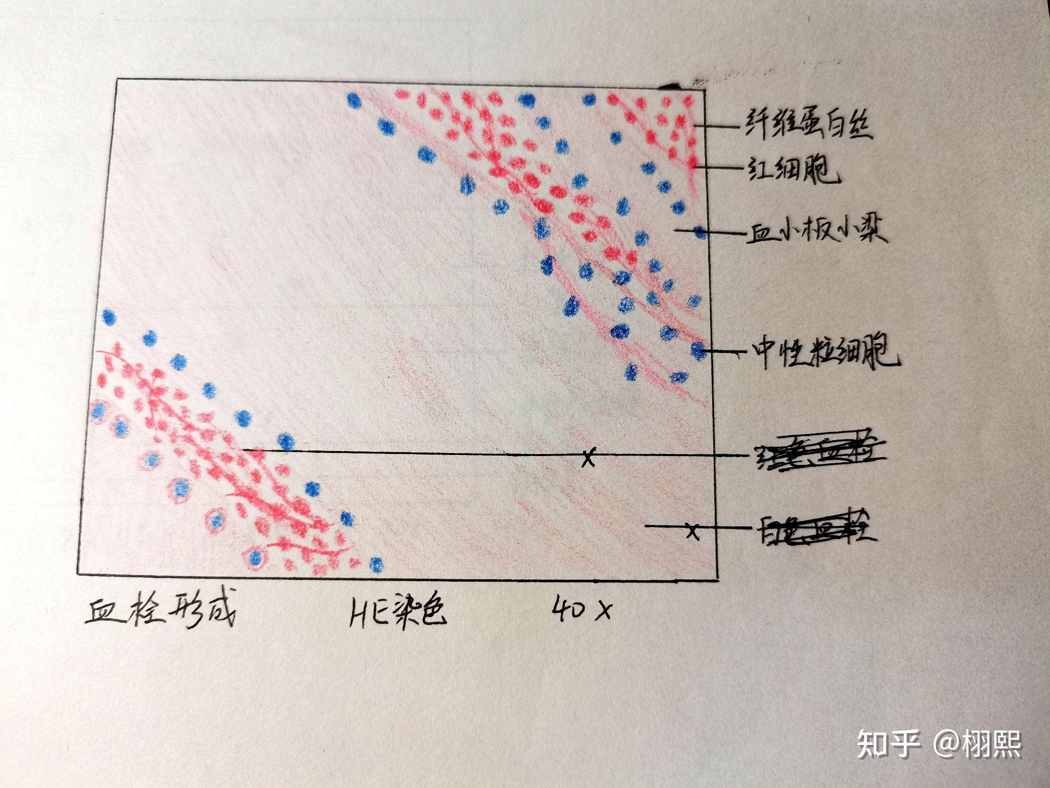 病理实验报告红蓝铅笔手绘图