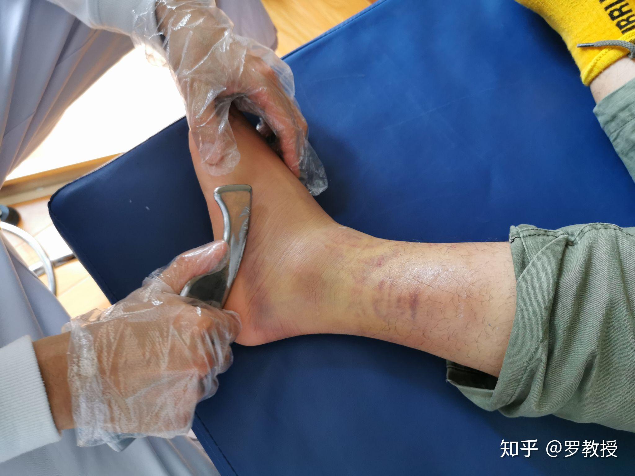 未病先防,风险筛查知多少?