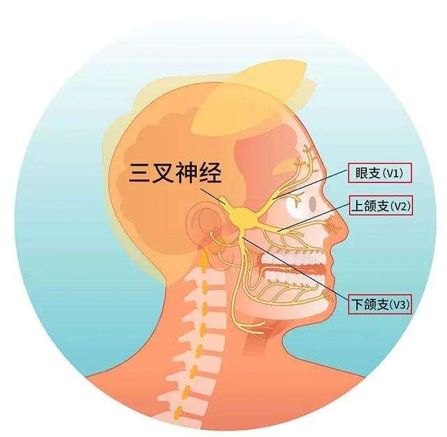 【诊断鉴别】典型三叉神经痛与非典型三叉神经痛