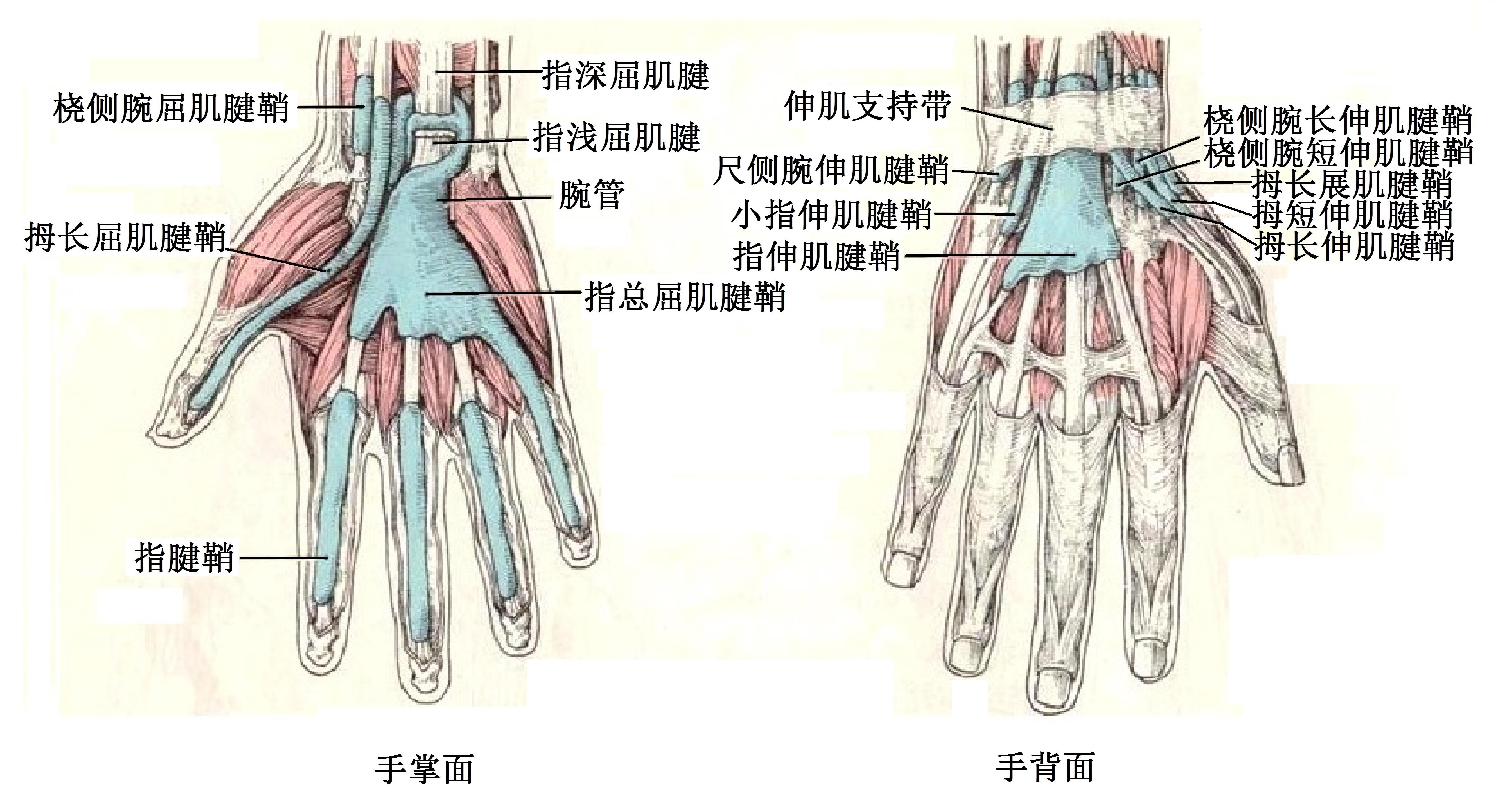 手指腱鞘炎原理图图片