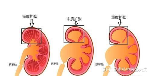 孕期產後寶媽內臟器官狀況是怎樣的如何預防發生病變