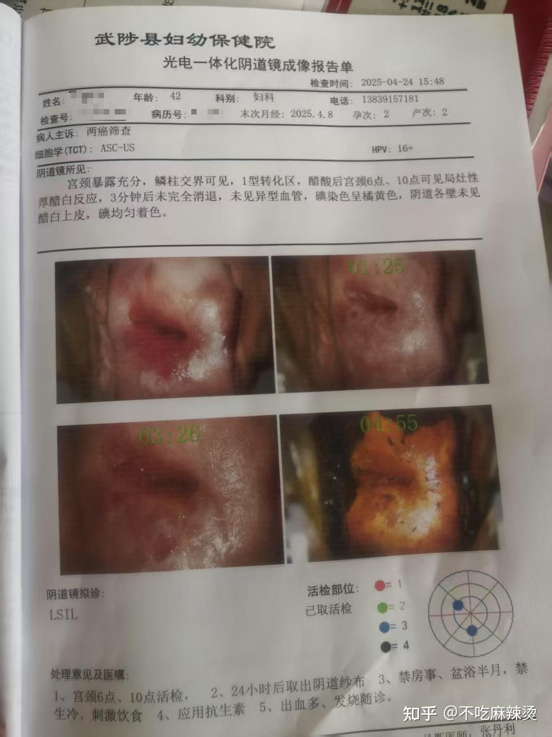 郑州科大医院再次提醒hpv感染别拖延!