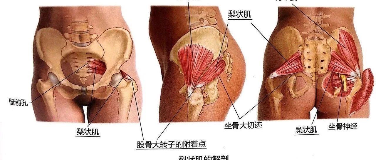 别再让腰间盘背锅了 腿麻臀痛的 元凶 可能是它 知乎