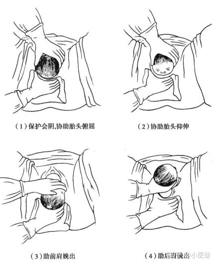 先兆临产图片