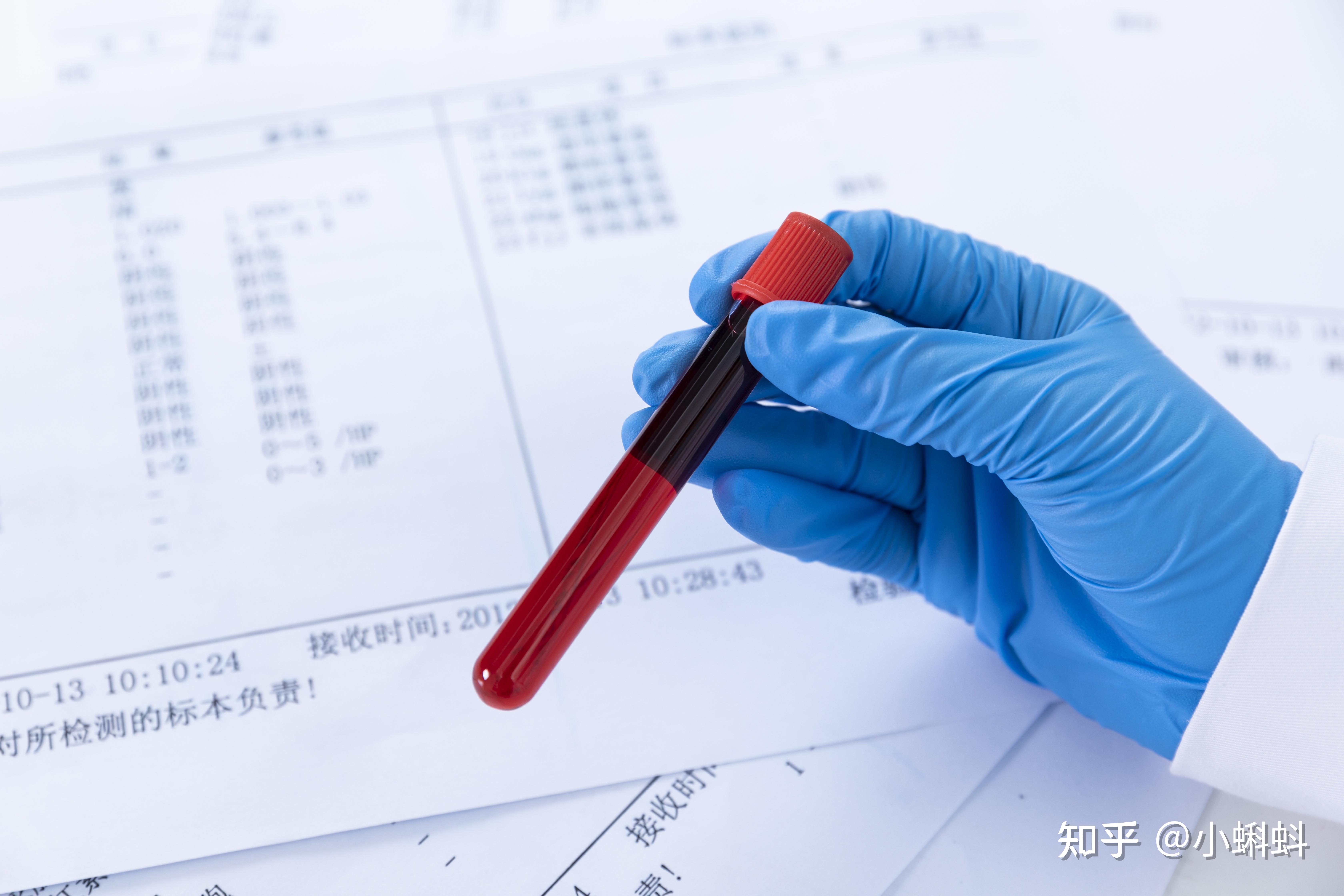 临床上也有很多人会拿着抽血化验的指标来咨询医生,说某某指标高了,是