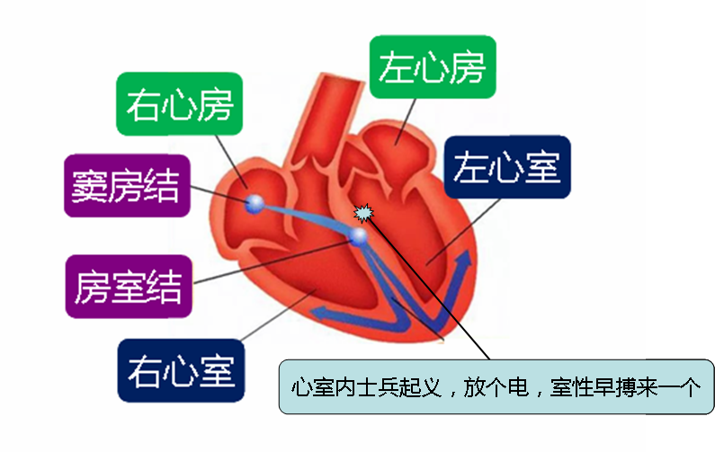 室性早搏是不是个病? - 知乎