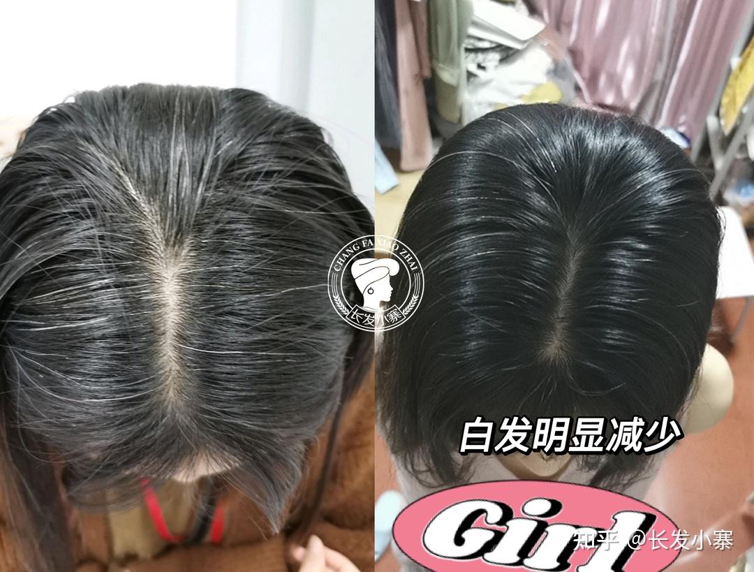长发小寨给您扒一扒黑发的科学,白发多久才能转黑? - 知乎