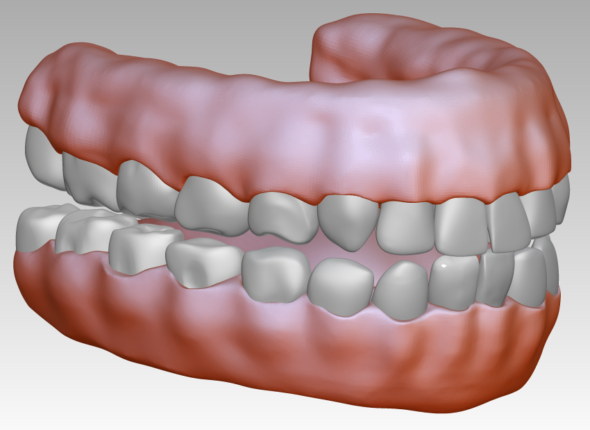牙齿牙龈3d图下载3d口腔模型下载逼真高清牙龈模型图片素材