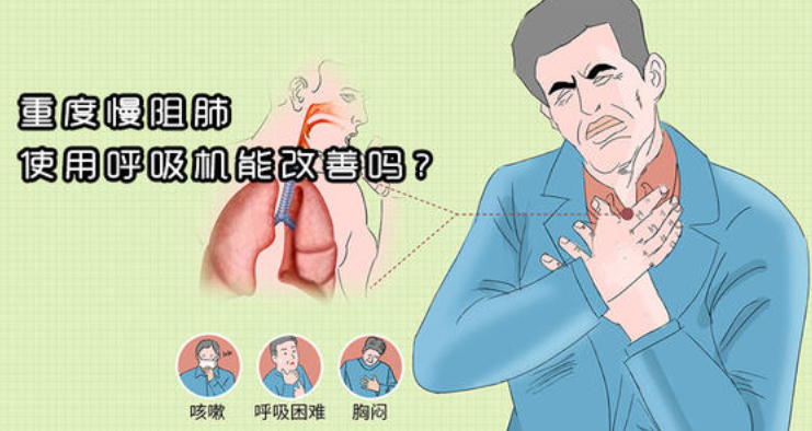 慢阻肺三大症状 zhuanlan.zhihu.com