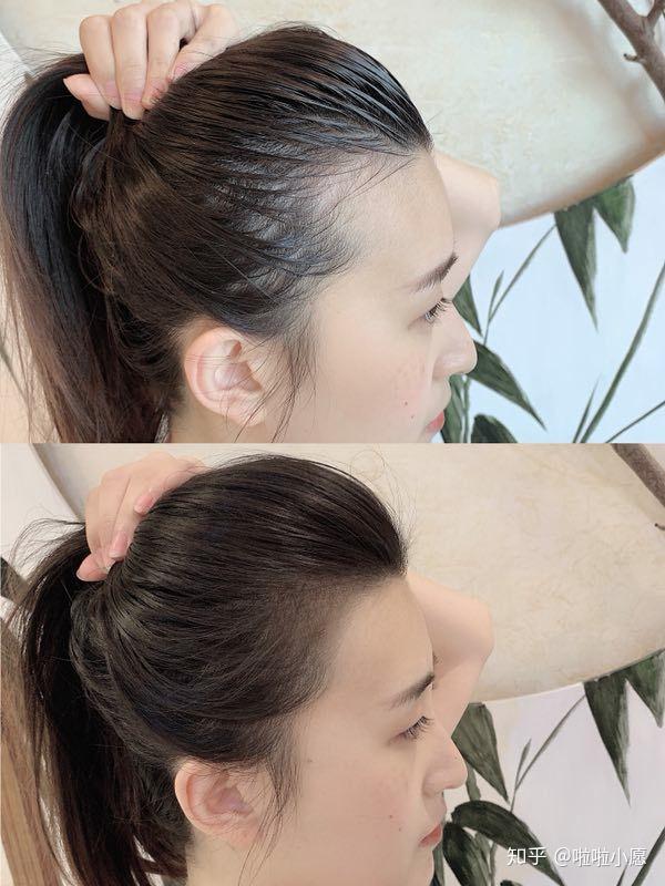 半永久发际线女明星一样需要