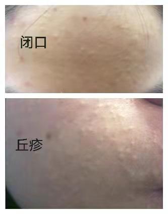 普通gsm机子用联通3g卡 有漫游没_如何护肤保养_护肤保养到底有用没