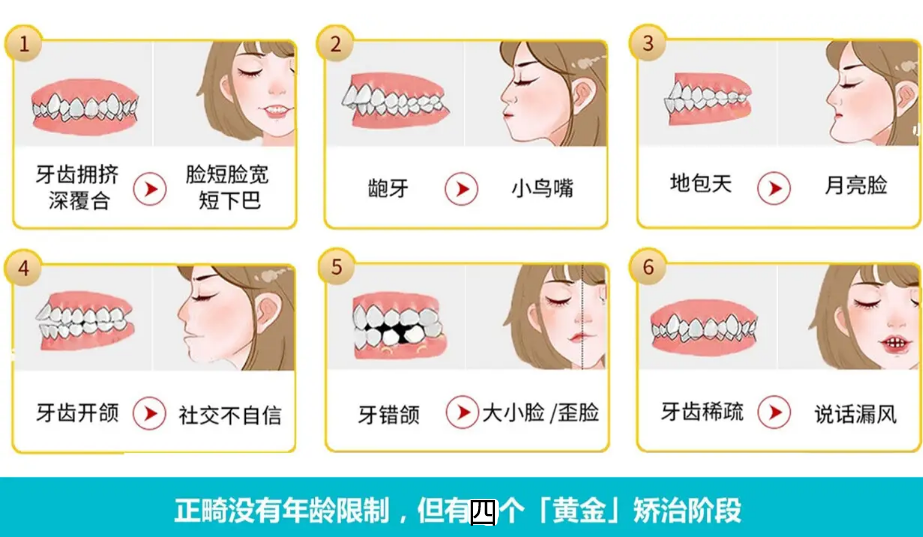 深圳牙齿矫正有哪些靠谱的医院什么年龄适合做牙齿矫正如何挑选适合的