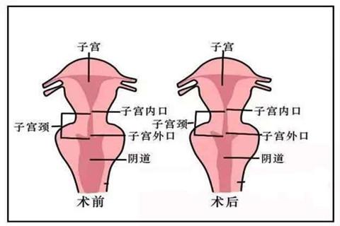 未成年的子宫图片