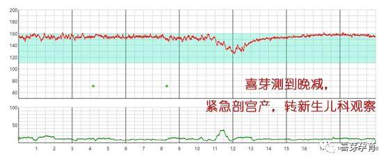 因此,当孕晚期出现假性宫缩,或者临产宫缩了,孕妈妈不必太过担忧胎