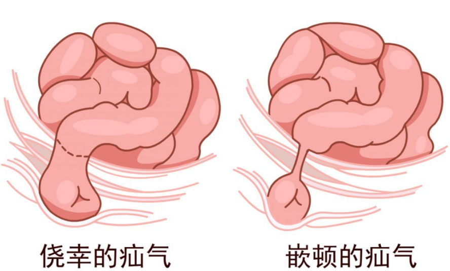 小儿疝气是什么病图片图片