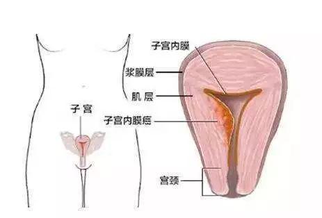怎样让内膜快速长起来 v2-52df3bd0d5ad94b27b297116d280c2b3_r.jpg