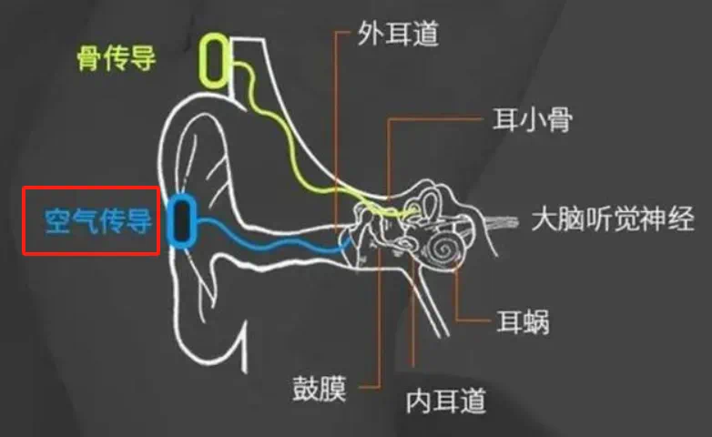 聲波經外耳引起骨膜振動,再經過外耳道,鼓膜,錘鼓以及前庭窗進入耳蝸