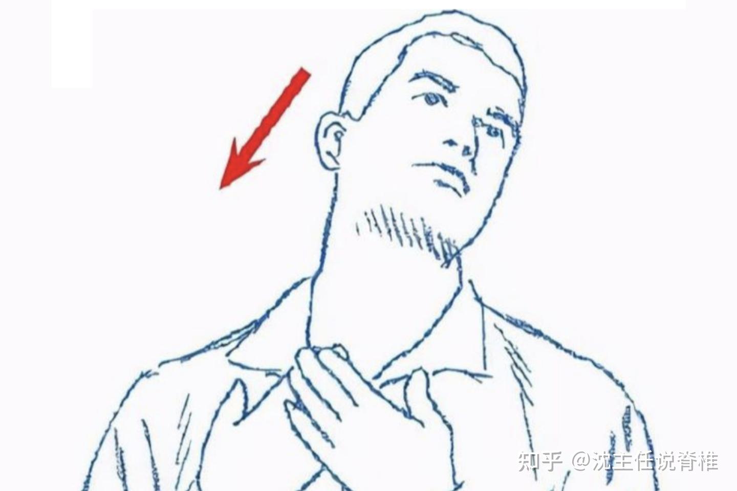 圆肩驼背、头前伸？让你气质减分的“上交叉综合征”该如何改善？ - 知乎