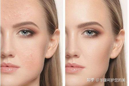 如何修复油性敏感肌？ - 知乎