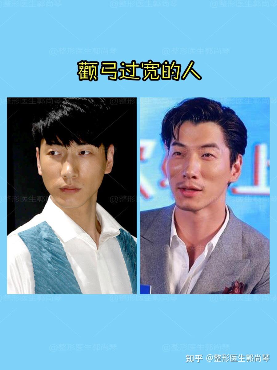 为什么填苹果肌后看起来不自然