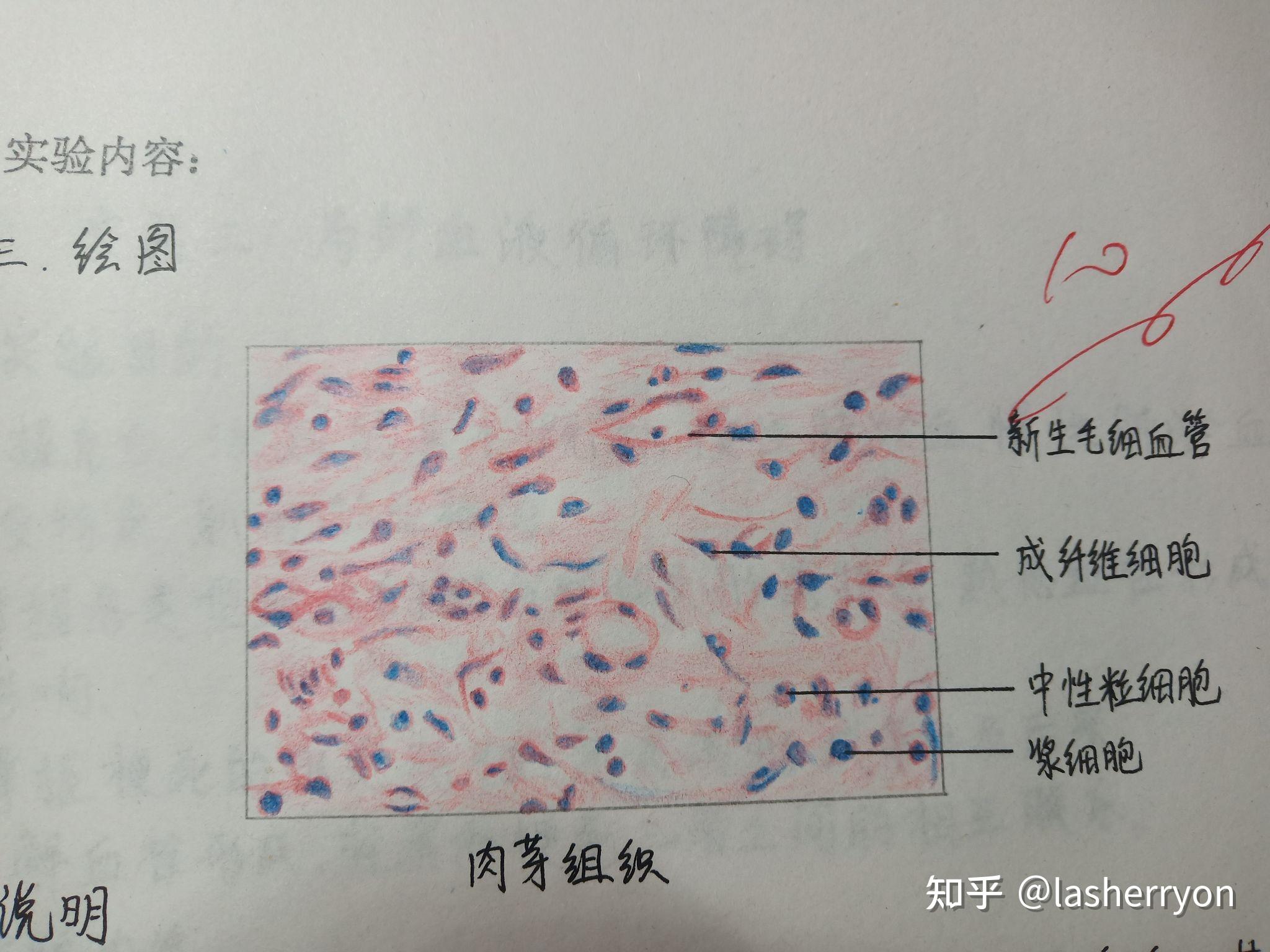成纤维细胞手绘红蓝图图片