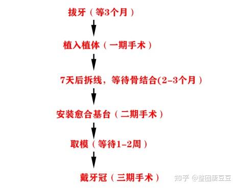 做种植牙前 一定要看的10条良心忠告 过来人血泪经验